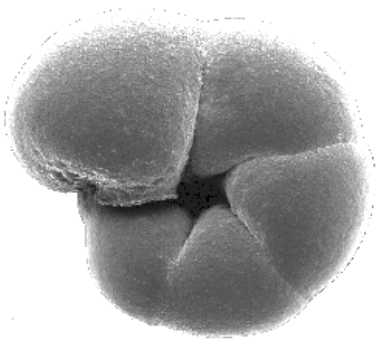 Figura 1:Foraminifera Trochammina inflata al microscopio